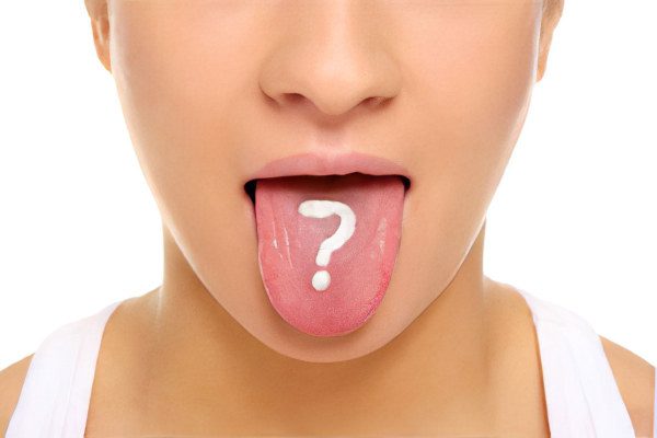 Mouth ulcers: how to treat?