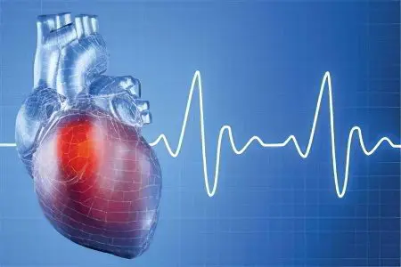 Myocardial infarction: the first symptoms, signs and consequences