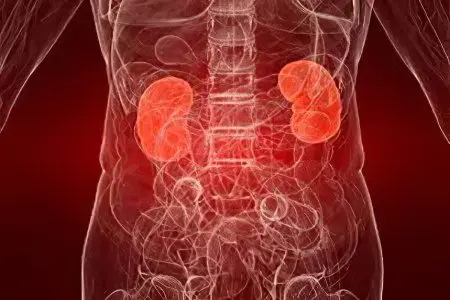 Nephrosis of the kidneys &#8211; what is it?