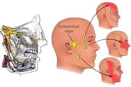 Neuritis: types, symptoms and treatment