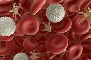 Neutropenia: causes, symptoms and treatment