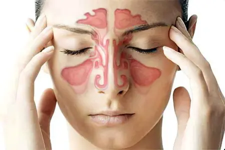 Nose pain: causes and treatment