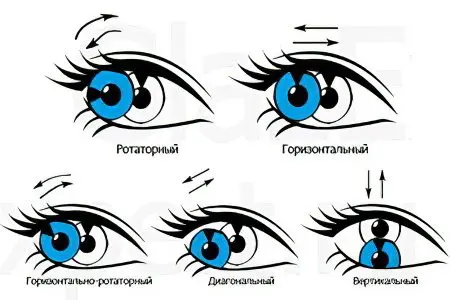 Nystagmus - what is it and how is it treated?