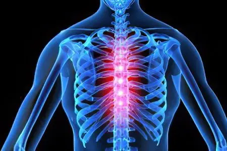 Osteochondrosis of the thoracic spine