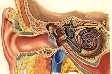 Otosclerosis: symptoms and treatments