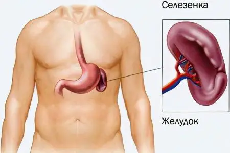 Pain in left side, lower abdomen