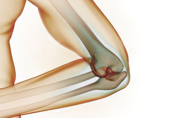 Pain in the elbow joint: what to do?