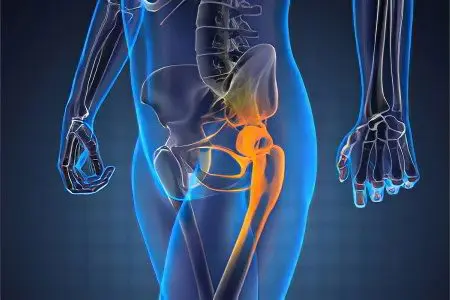 Pain in the hip - what could it be?