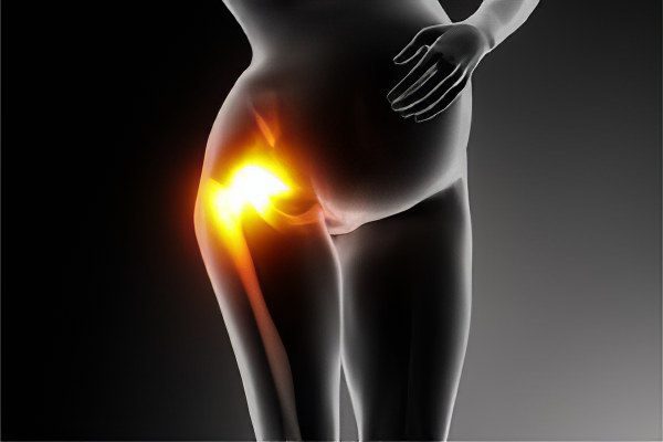 Pain in the hip - what could it be?