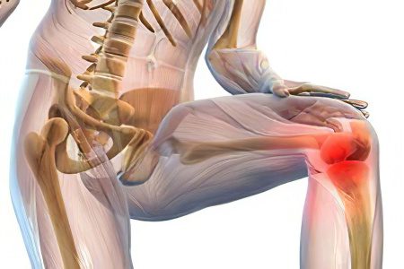 Pain in the muscles of the legs: what to do?