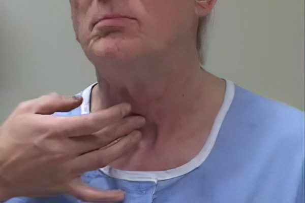 Palpation of the thyroid gland