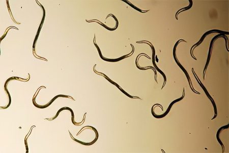 Parasites in the human body