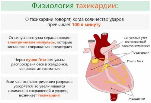 Paroxysmal tachycardia