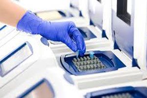 PCR analysis: what is it? What are the 12 infections for rent?