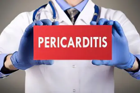 Pericarditis: what is it? Symptoms and treatment