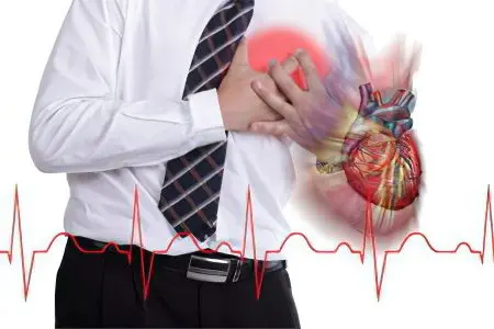 Pericarditis: what is it? Symptoms and treatment