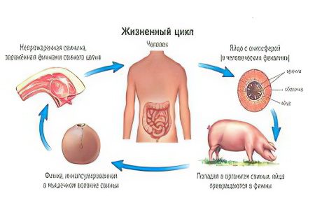 Pig tapeworm in humans