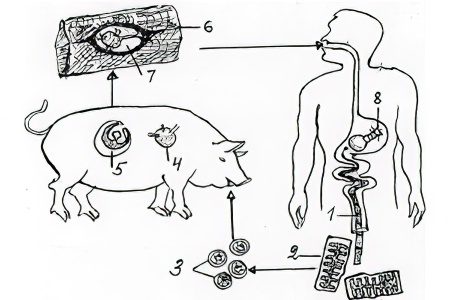 Pig tapeworm in humans