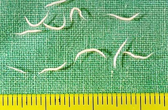 Pinworms in adults: symptoms and treatment