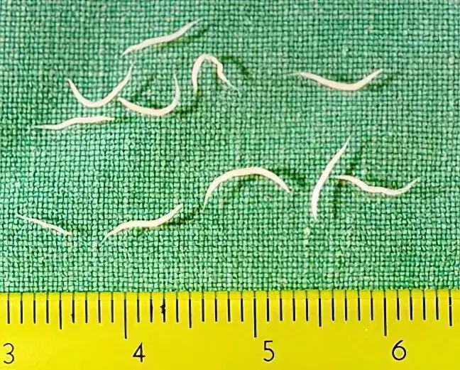 Pinworms in adults: symptoms and treatment