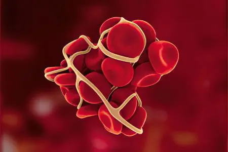 Platelet aggregation: what is it and what is the norm?