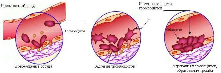 Platelet aggregation: what is it and what is the norm?