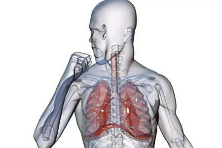 Pneumosclerosis of the lungs