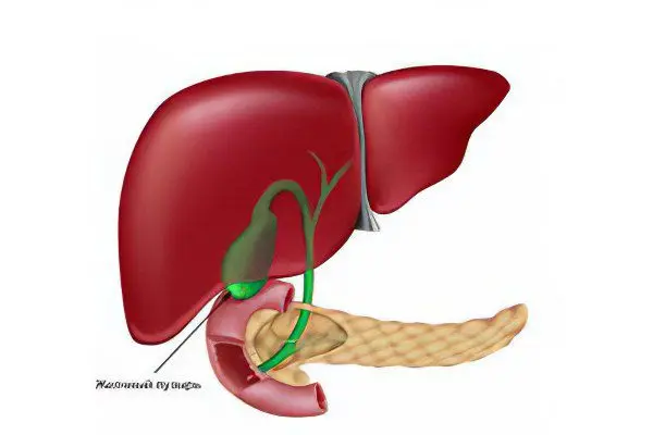 Polyps in the gallbladder - what to do?