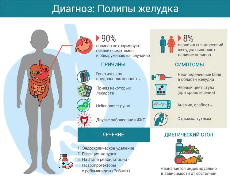 Polyps in the stomach &#8211; is it dangerous? How to treat?