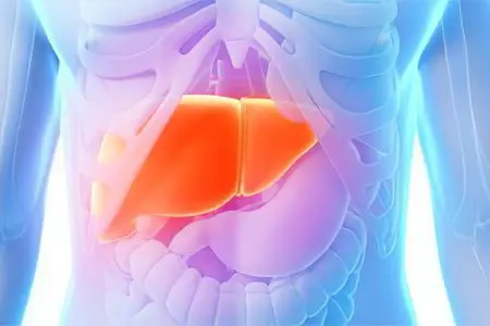 Portal cirrhosis of the liver