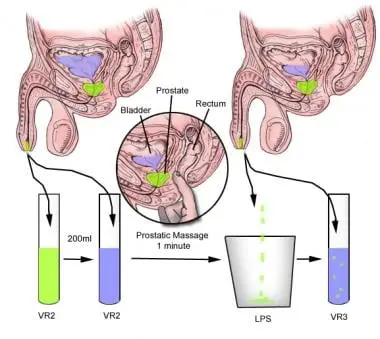 Prostate massage