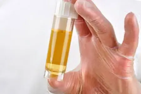 Protein in urine