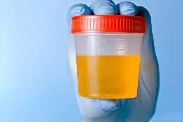 Protein in urine in men