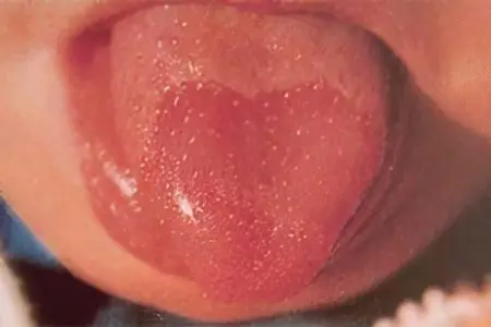 Red coating on the tongue