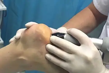 Removal of calluses on the feet