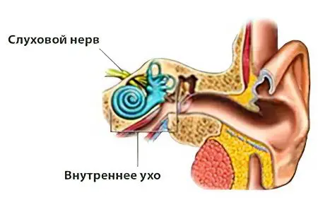 Sensorineural hearing loss