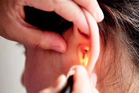 Sensorineural hearing loss