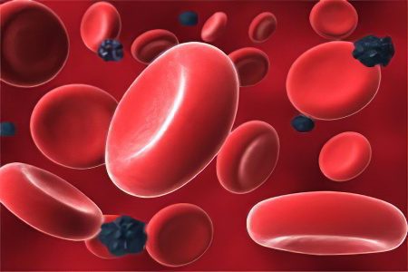 Signs, symptoms, stages and treatment of blood cancer