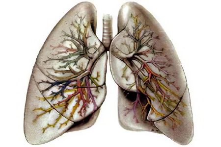 Signs, symptoms, stages and treatment of lung cancer