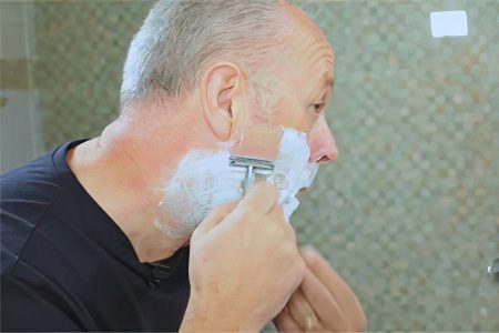 Skin irritation after shaving