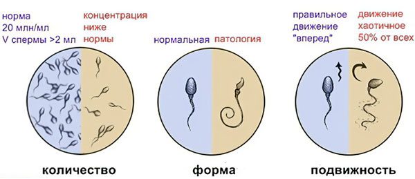 Spermogram: norm and interpretation of the results