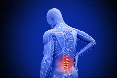 Spondylosis of the spine: stages, symptoms and treatment