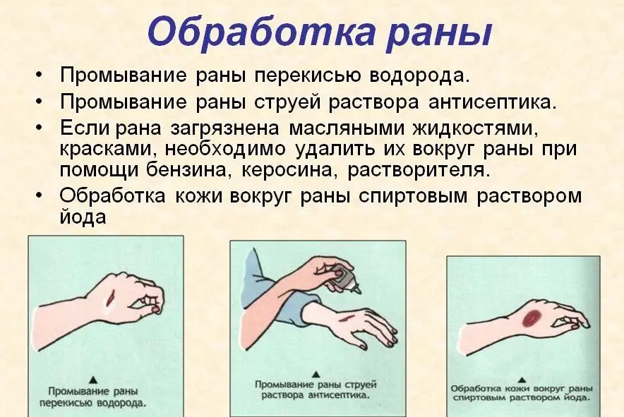 Stages of treatment of open wounds