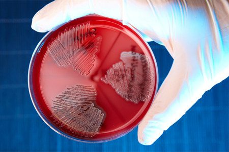 Streptococcus: causes of infection, diseases caused by it, treatment