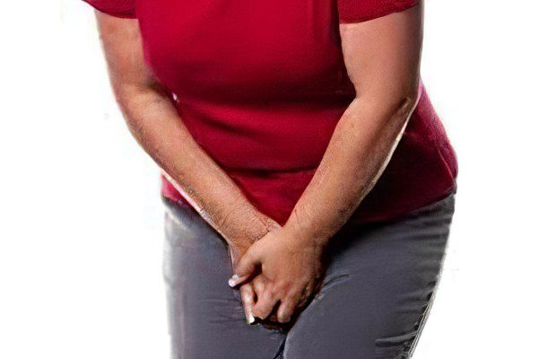 stress urinary incontinence