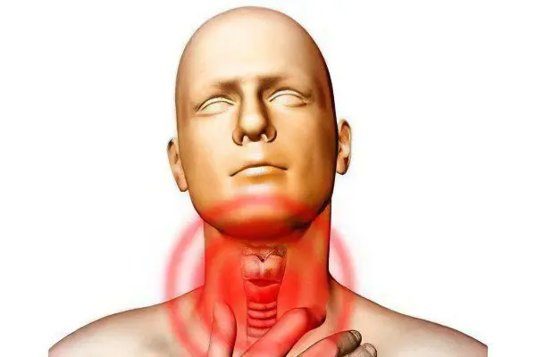 subclinical hypothyroidism