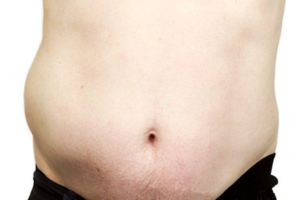 Symptoms and treatment of dropsy of the abdomen