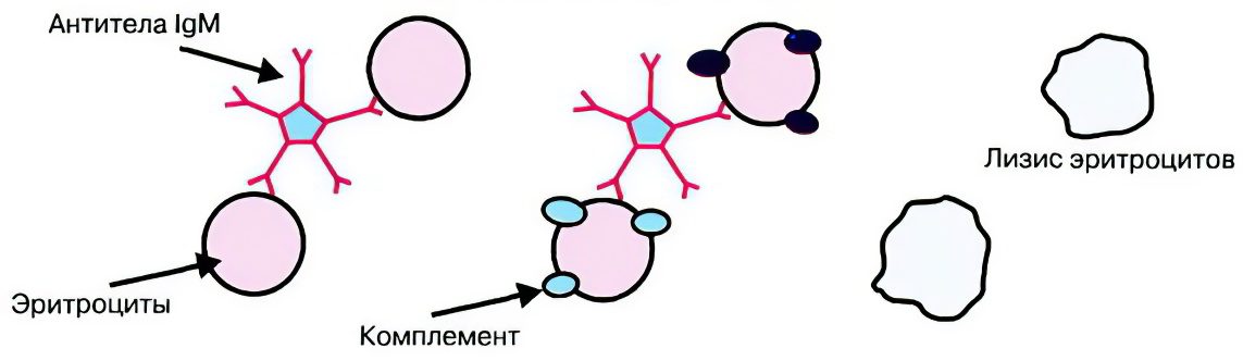 Symptoms and treatment of hemolytic anemia