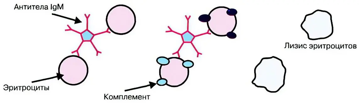 Symptoms and treatment of hemolytic anemia