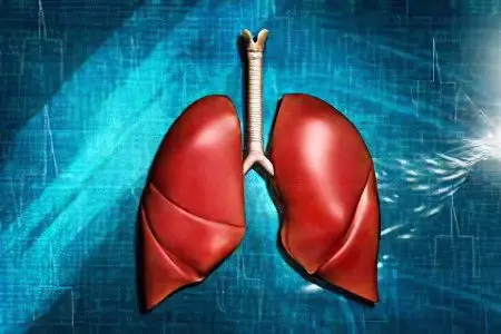 Symptoms, causes and treatment of pulmonary edema